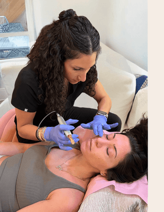 Microneedling